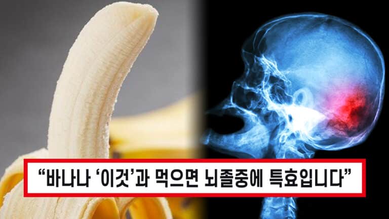 “뇌졸중 확실하게 막아줍니다” 바나나와 ‘이걸’ 함께 먹으면 뇌졸중 얼씬도 못한다고