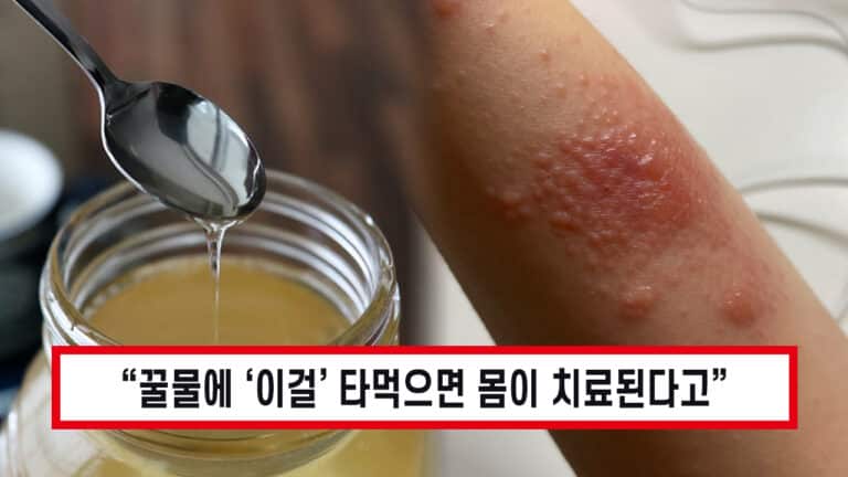 꿀물에 ‘이것’ 넣어 먹으면 관절 통증과 염증이 싹 사라진다!
